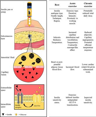 Factors Influencing Insulin Absorption Around Exercise in Type 1 Diabetes